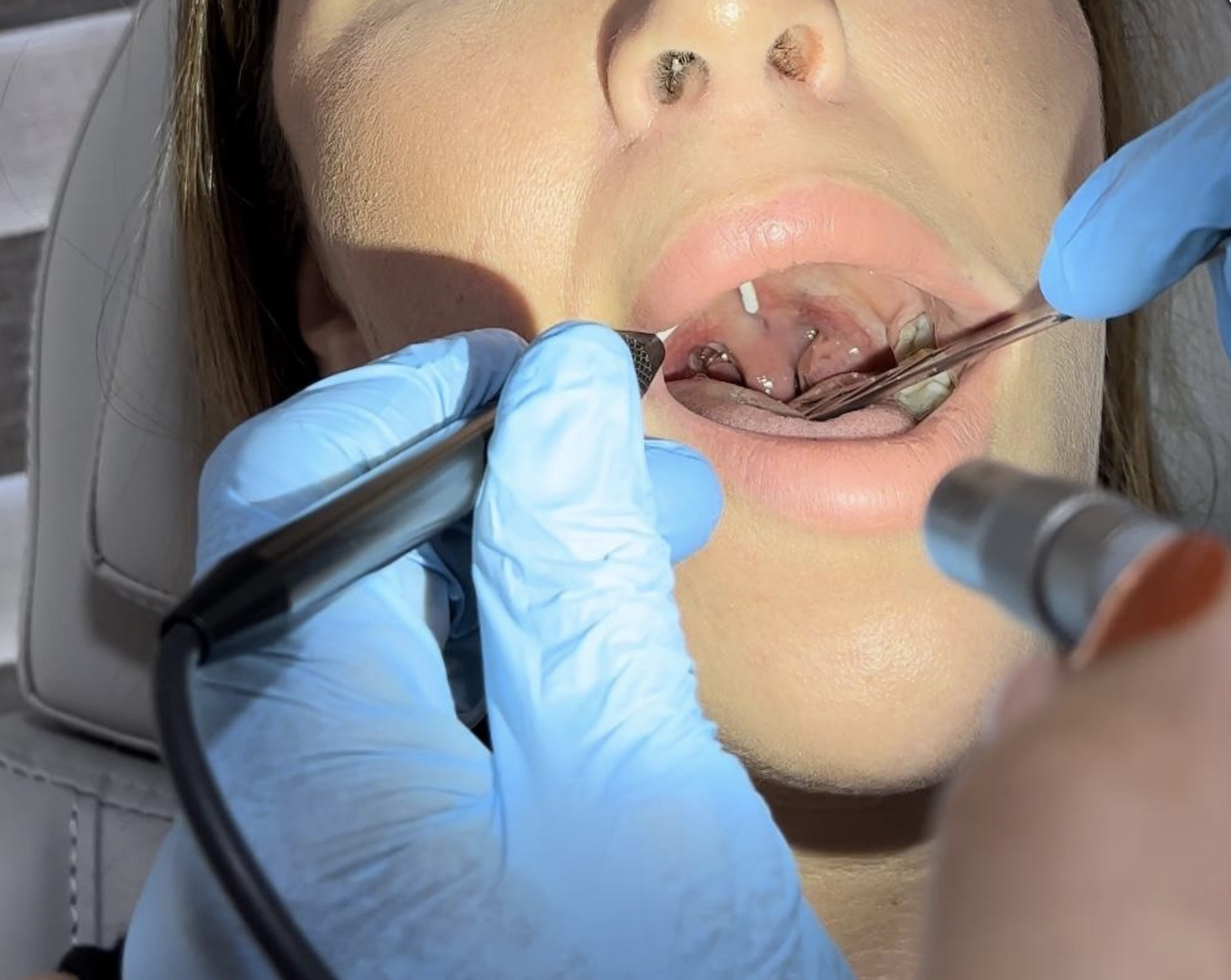 Prof.Dr. Arif Şanlı Kulak Burun Boğaz Cerrahisi