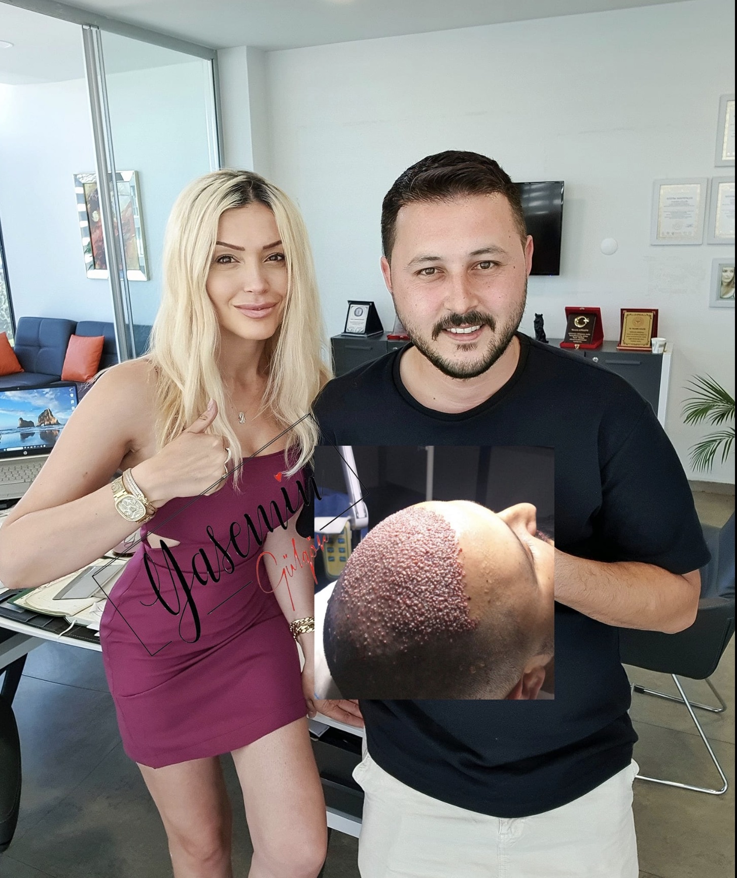 Clinic Yasemin Saç Ekim Merkezi