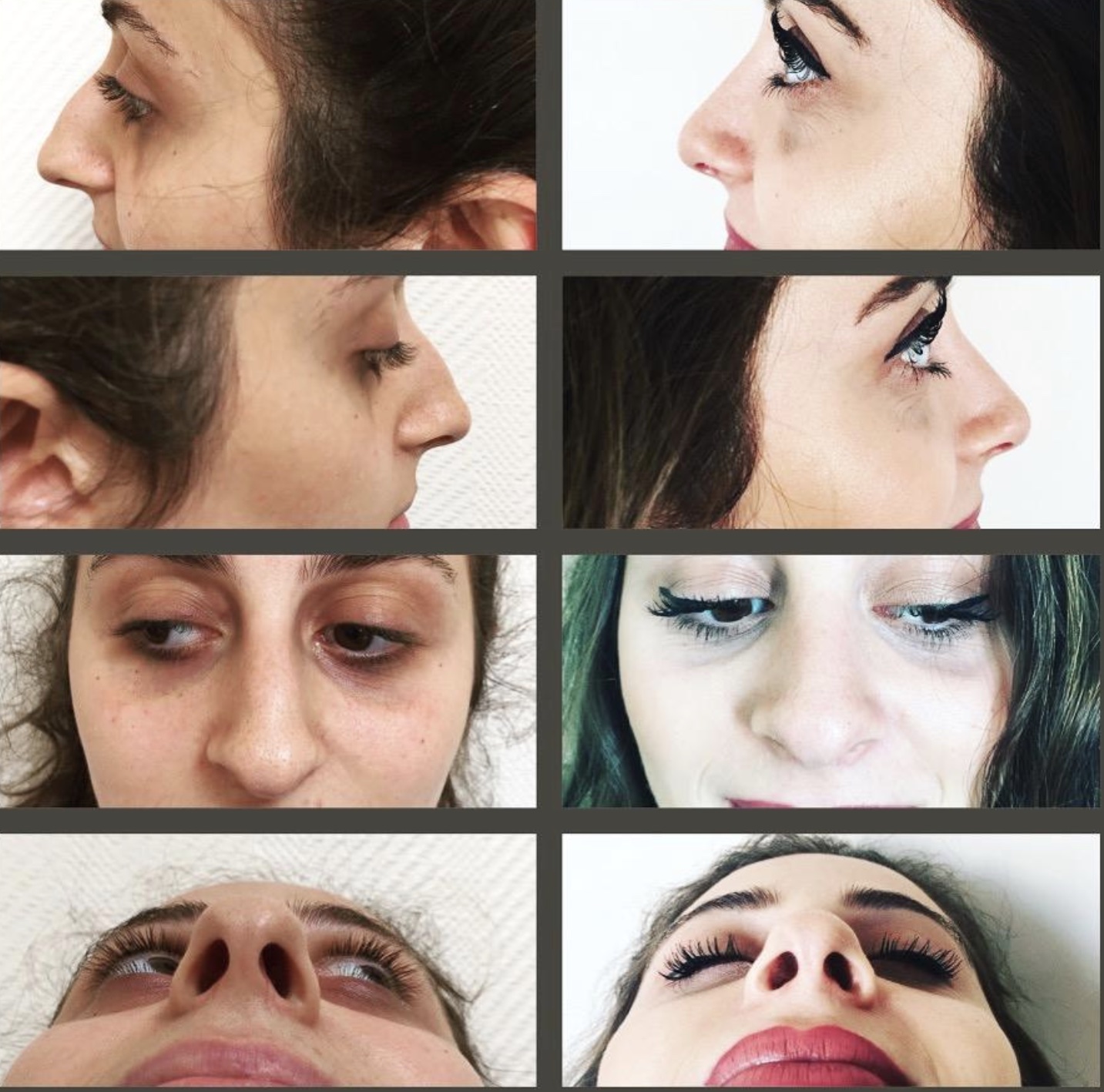 Prof.Dr. Arif Şanlı Kulak Burun Boğaz Cerrahisi